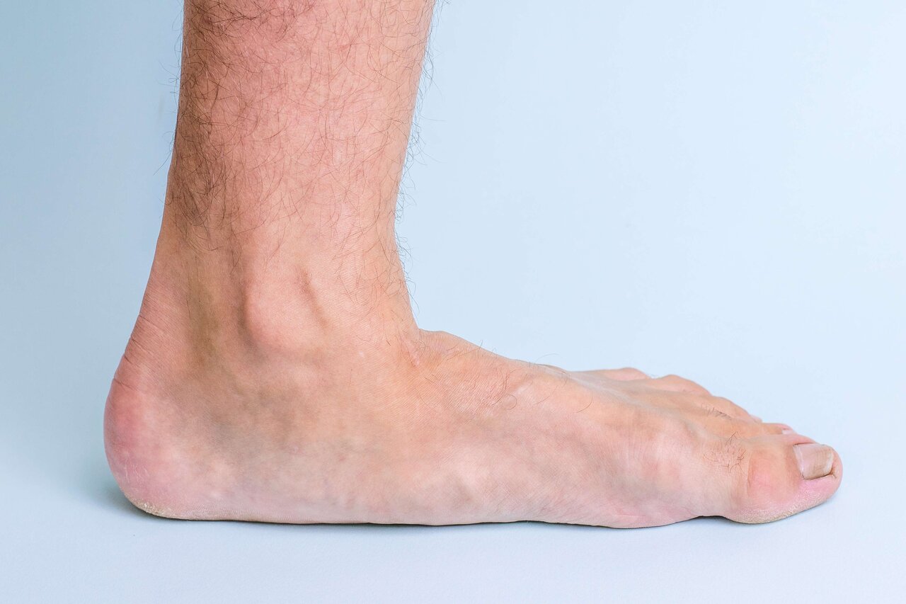 фото болезней ног